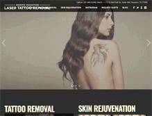 Tablet Screenshot of northhoustonlasertattooremoval.com